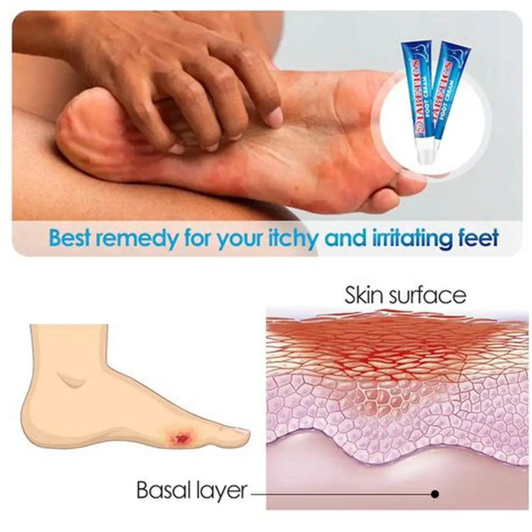 Illustration of diabetic foot care